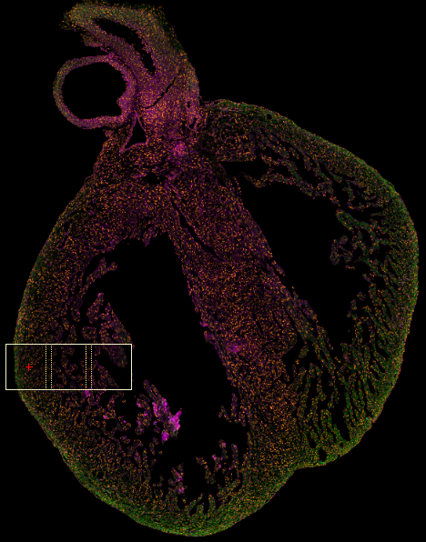 Cardiomyocyte Orientation