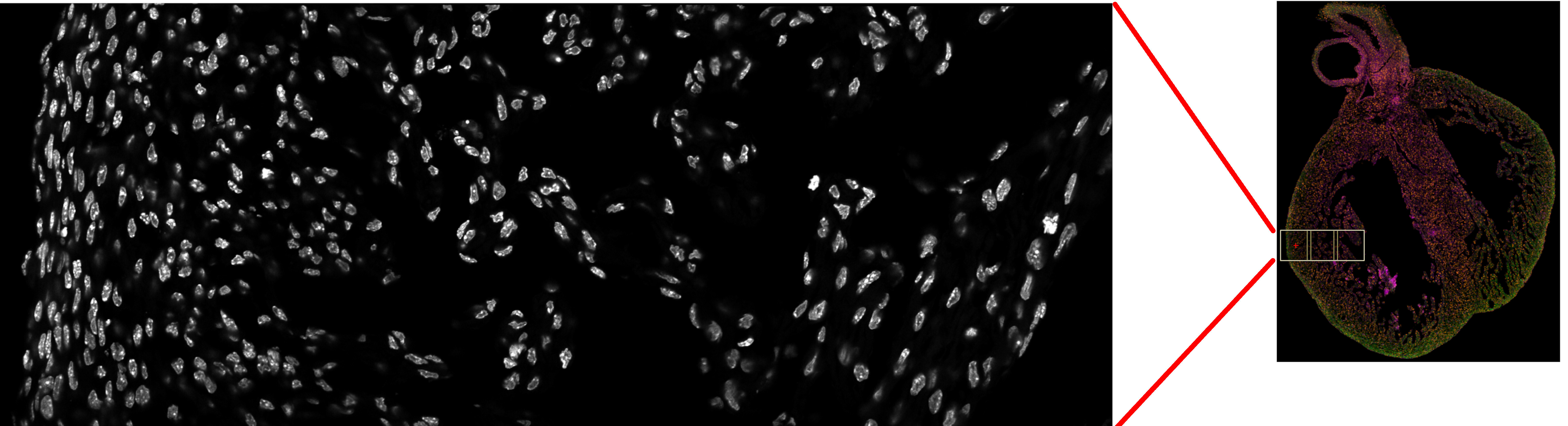 Cardiomyocyte Research